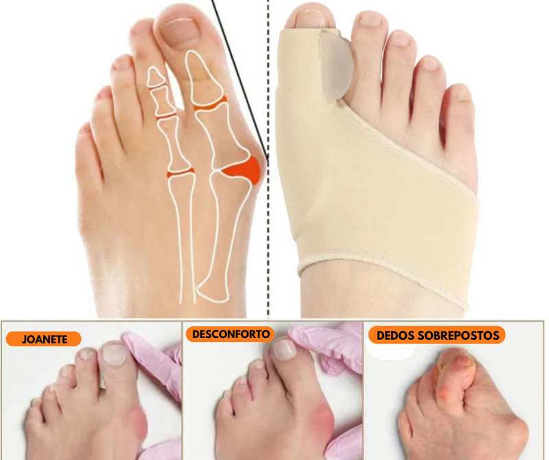 Joanete Ortox - Par de meias Ortopédicas de Correção e alivio da dor.